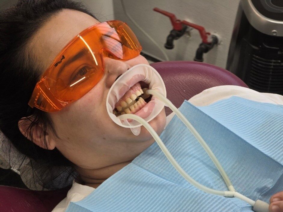 nanowhite_tandenbleken Patiënt ondergaat veilige tandbleekprocedure met licht. Effectief tanden bleken.