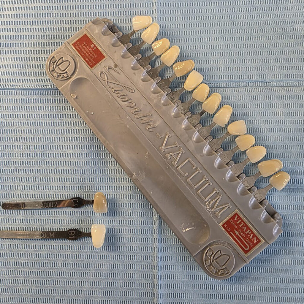 nanowhite_tandenbleken VITA Lumin Vacuum kleurenkaart met tandkleurstalen. Tandkleurvergelijking.